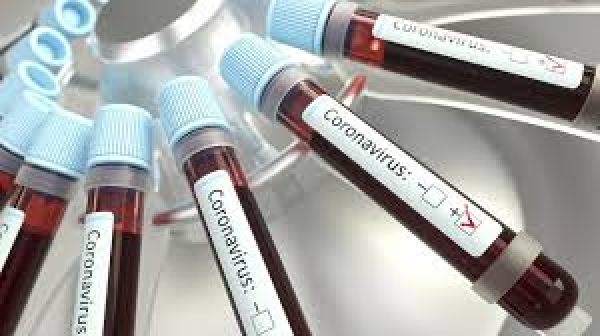 Confirmed coronavirus cases in Sri Lanka reaches 100