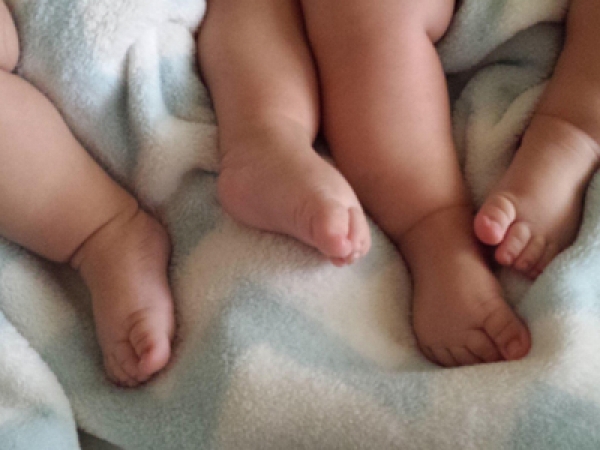 Quintuplets born at De Soysa Hospital, Colombo
