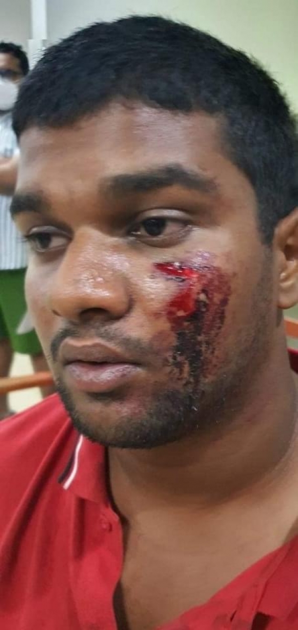Young Law Student Brutally Assaulted By OIC Of Peliyagoda Police Station For Attempting To Ensure The Safety Of Suspect